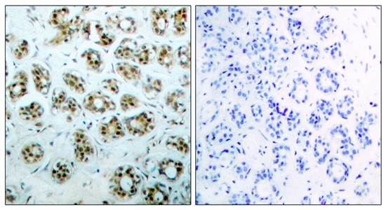 NFκB-p65((phospho-Ser311) Antibody