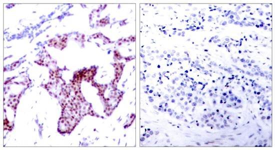 NFκB-p65 (Phospho-Ser276) Antibody