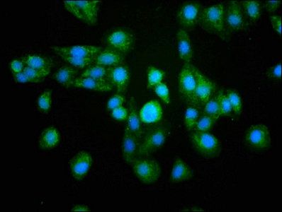RELA Antibody