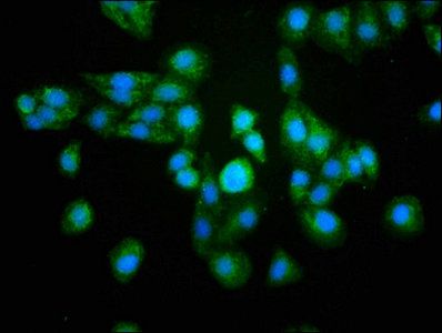 NFkB p65 antibody