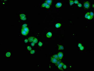 NFkB p65 antibody