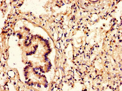 RELA Antibody