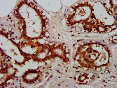 RELA Antibody