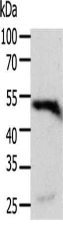 RELA Antibody