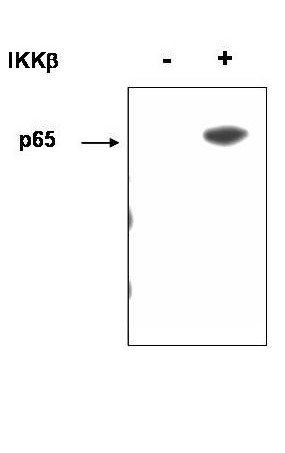 NFkB p65 (phospho-S536) antibody
