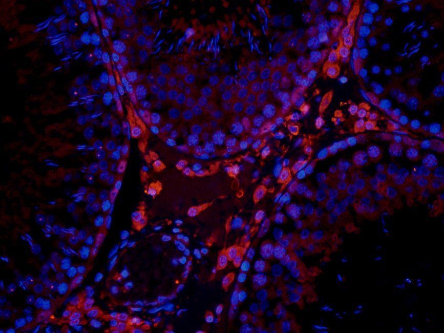 NFKB1 antibody