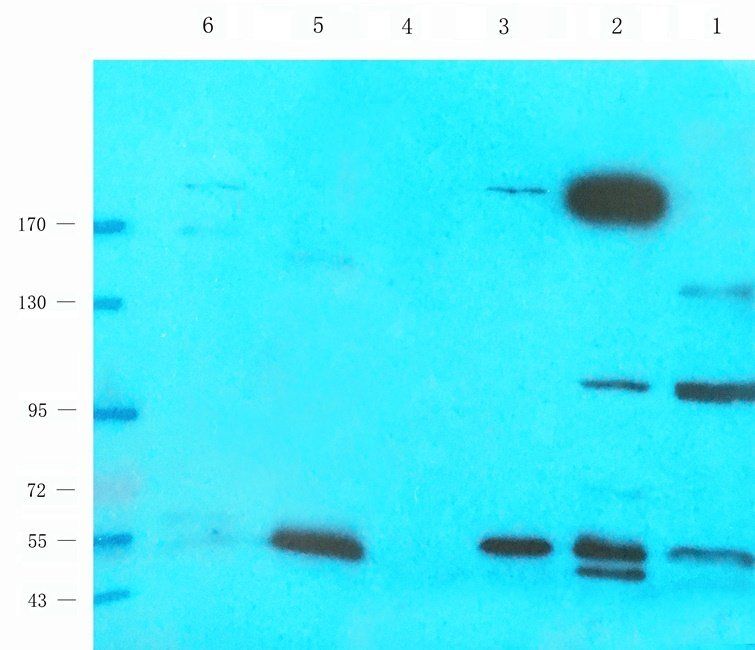 NFKB1 antibody