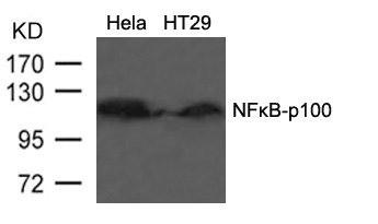 NFKB2 (Ab-866) antibody