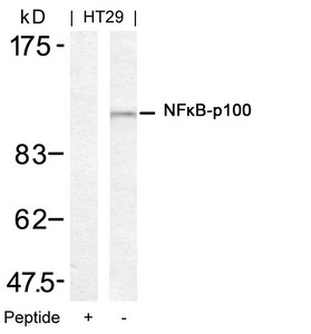 NFKB2 (Ab-872) antibody