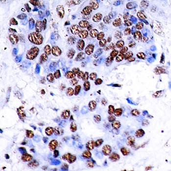 NFκB-p65 (Ab-276) Antibody