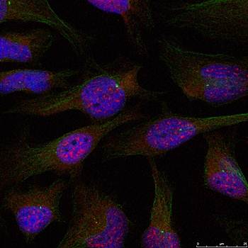 NFκB-p65 (Ab-276) Antibody