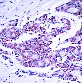 NFκB-p65 (Ab-468) Antibody