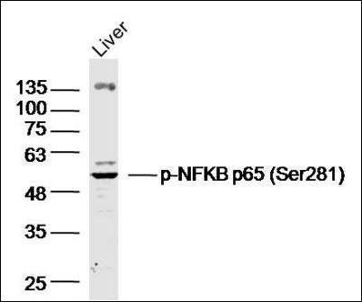 NFkB p65 (phospho-Ser281) antibody