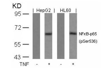 NFκB-p65 (Phospho-Ser536) Antibody