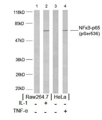 NFκB-p65 (Phospho-Ser536) Antibody