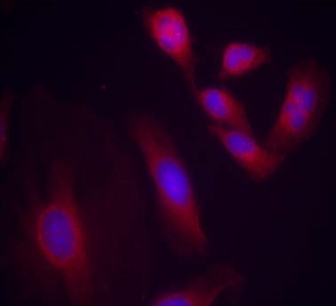 NFκB-p65 (Phospho-Ser536) Antibody