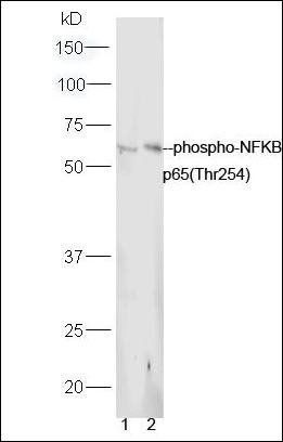 NFKB p65 (phospho-Thr254) antibody