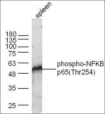 NFKB p65 (phospho-Thr254) antibody