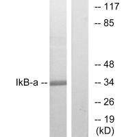 NFKBIA (Ab-32/36) antibody