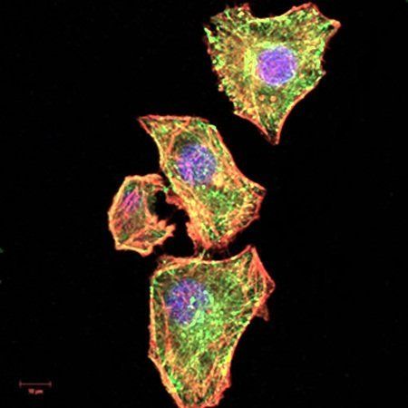 NFKBIA Antibody