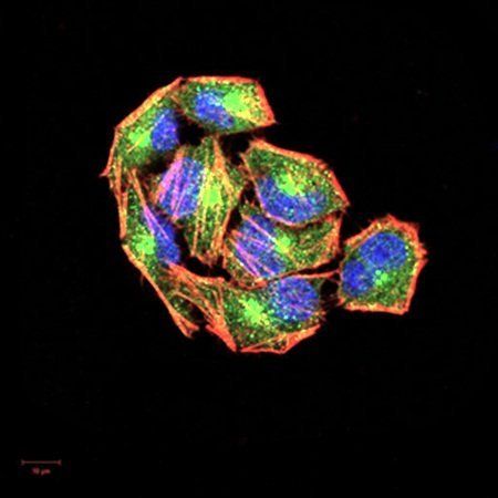 NFKBIA Antibody