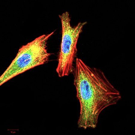 NFKBIA Antibody