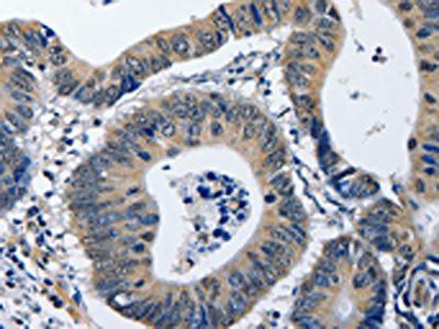 NFKBID Antibody
