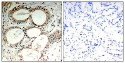 NFKBIE Antibody