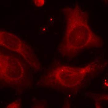 NFκB-p105(Phospho-Ser927) Antibody