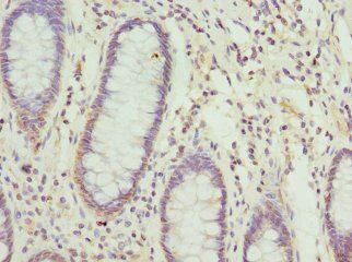 NFS1 Antibody