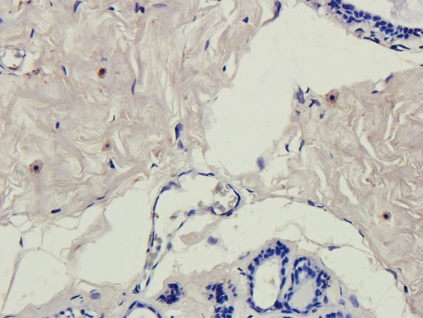 NG2 antibody