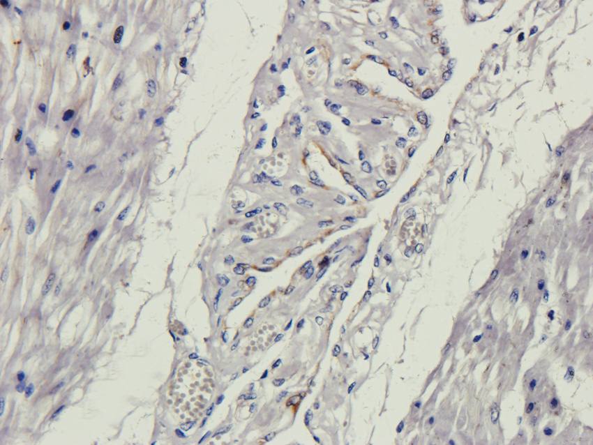 NG2 antibody