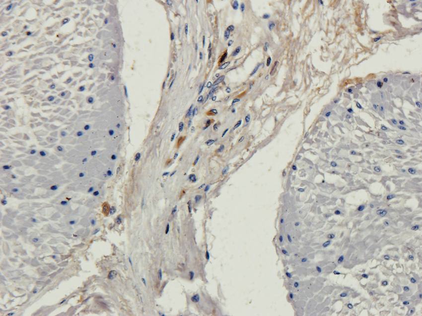 NG2 antibody