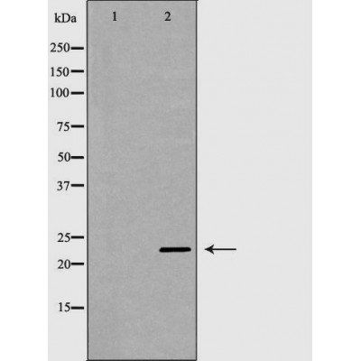 LCN2 Antibody