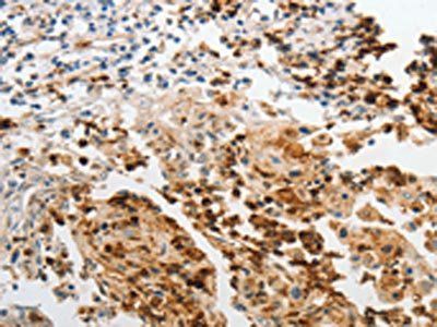 LCN2 Antibody