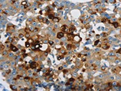 LCN2 Antibody