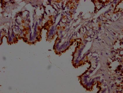 Lcn2 Antibody