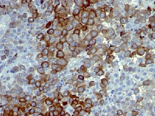 NGF-Receptor (p75) / CD271 (Soft Tissue Tumor Marker) Antibody