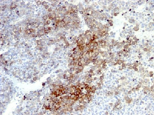 NGF-Receptor (p75) / CD271 (Soft Tissue Tumor Marker) Antibody