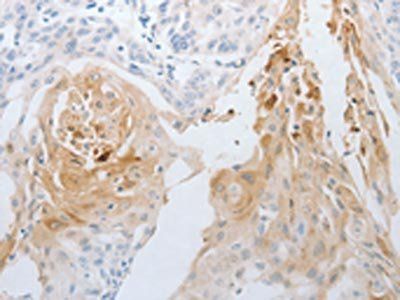 NGFR Antibody