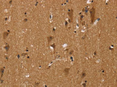 NGFRAP1 Antibody