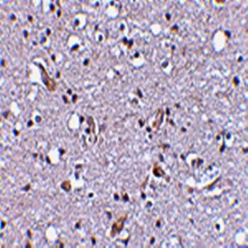 Nhe Antibody