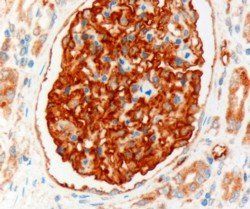 Goat anti-NHERF2 (isoform a) Antibody