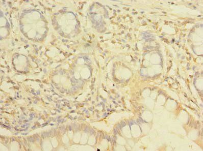 NHLRC2 Antibody