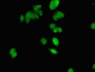 NHP2 antibody