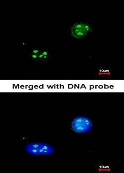 NHP2-like protein 1 antibody