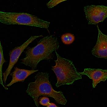 Niban Rabbit Polyclonal Antibody