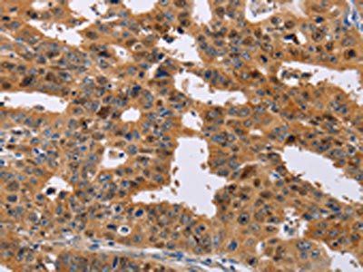 NIF3L1 Antibody