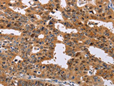 NIF3L1 antibody