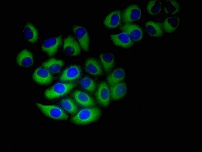 NINJ1 antibody